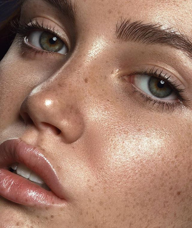 How to protect your freckles!