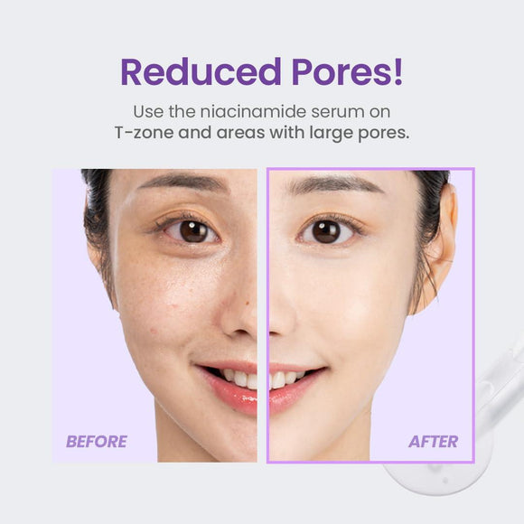 TIRTIR Niacinamide 20% serum Ορός Προσώπου 30ml