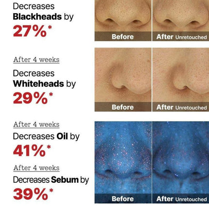 COSRX The AHA 2% BHA 2% Blemish Treatment Serum – Ορός Απολέπισης & Κατά της Ακμής 50g