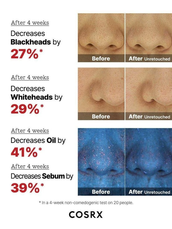 COSRX The AHA 2% BHA 2% Blemish Treatment Serum – Ορός Απολέπισης & Κατά της Ακμής 50g