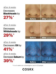 COSRX The AHA 2% BHA 2% Blemish Treatment Serum Ορός Απολέπισης & Κατά της Ακμής 50g