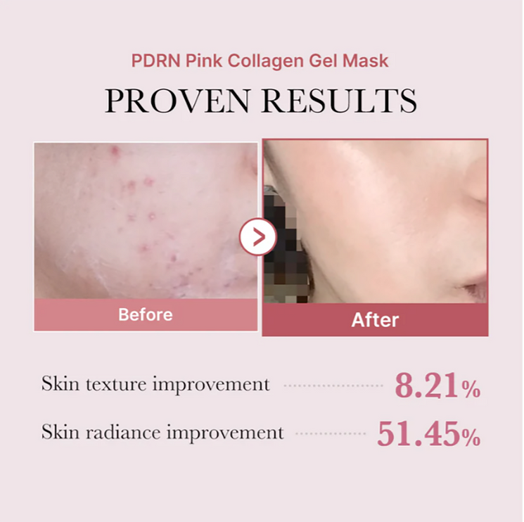 MEDICUBE -  Pdrn Pink Collagen Gel Mask