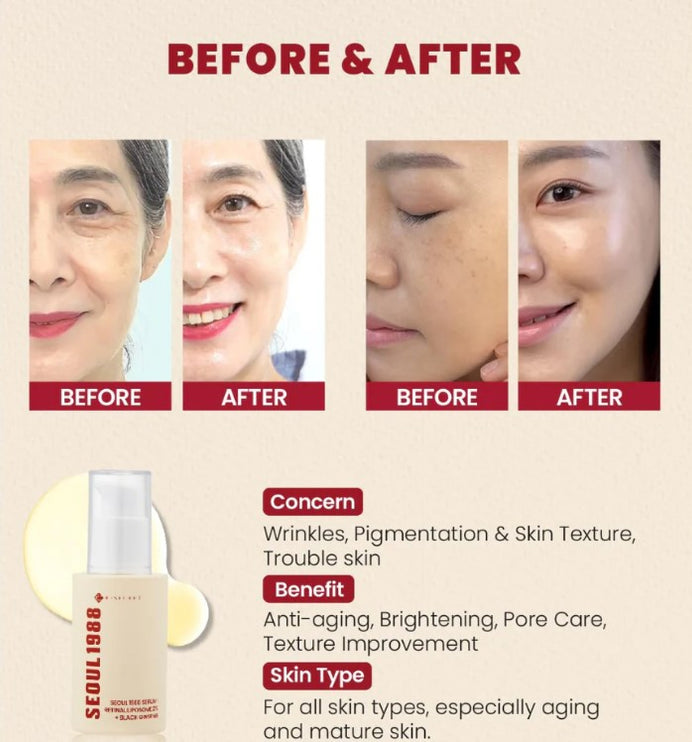K - SECRET SEOUL 1988 - SEOUL 1988 Serum: Retinal Liposome 2% + Black Ginseng 30ml