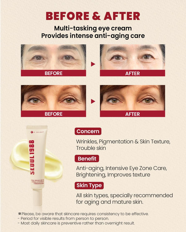 K - SECRET SEOUL 1988 - SEOUL 1988 Eye Cream: Retinal Liposome 4% + Fermented Bean 30ml