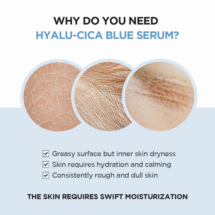 SKIN1004 - Madagascar Centella Hyalu-Cica Blue Serum 50ml