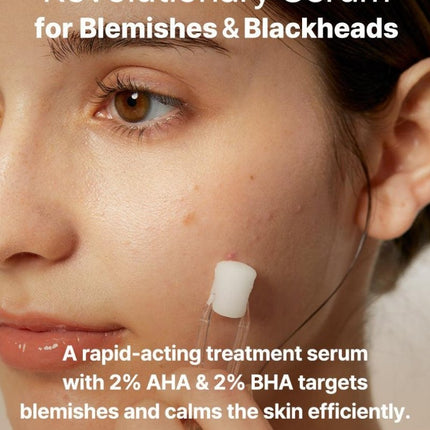 COSRX The AHA 2% BHA 2% Blemish Treatment Serum – Ορός Απολέπισης & Κατά της Ακμής 50g